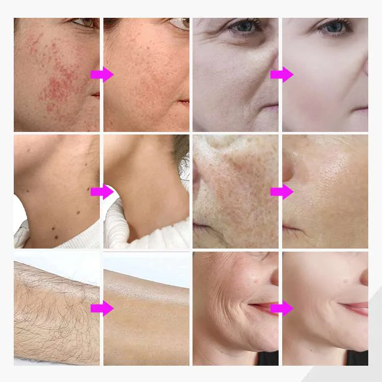 Before and after hair removal and skin treatment examples