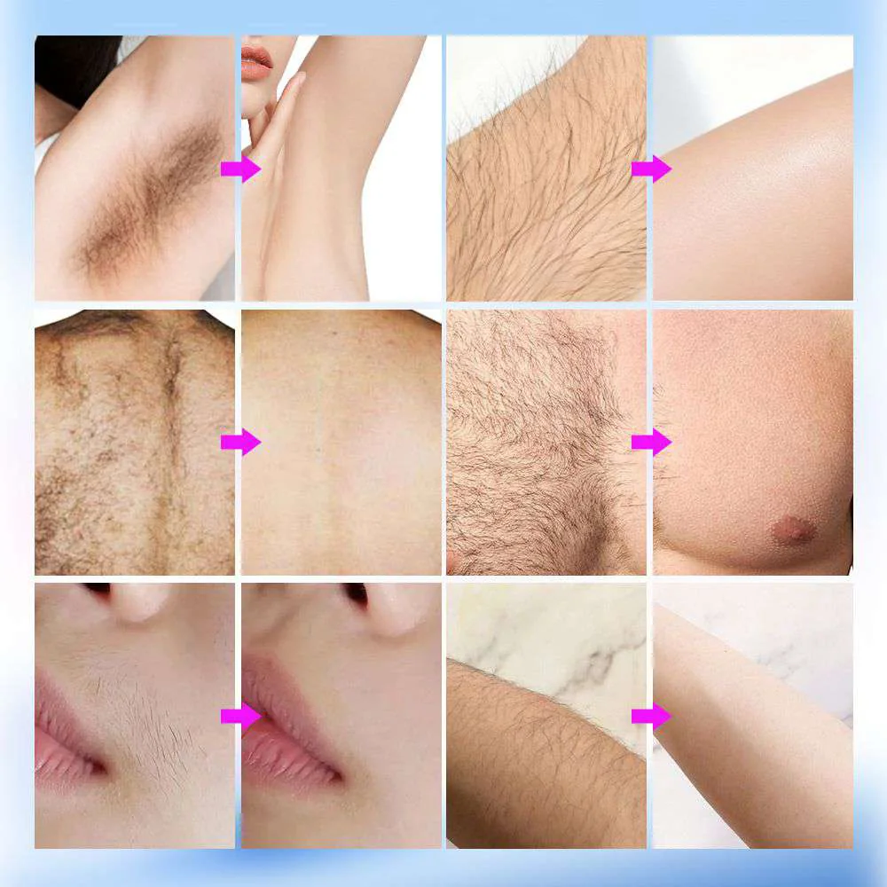 Before and after hair removal and skin treatment examples
