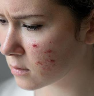 Photoaging & Texture Renewal